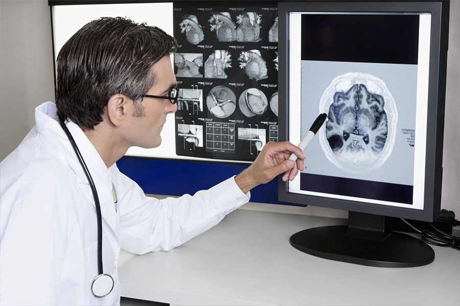 Doctor looking at a brain scan concept image for mental health genetics